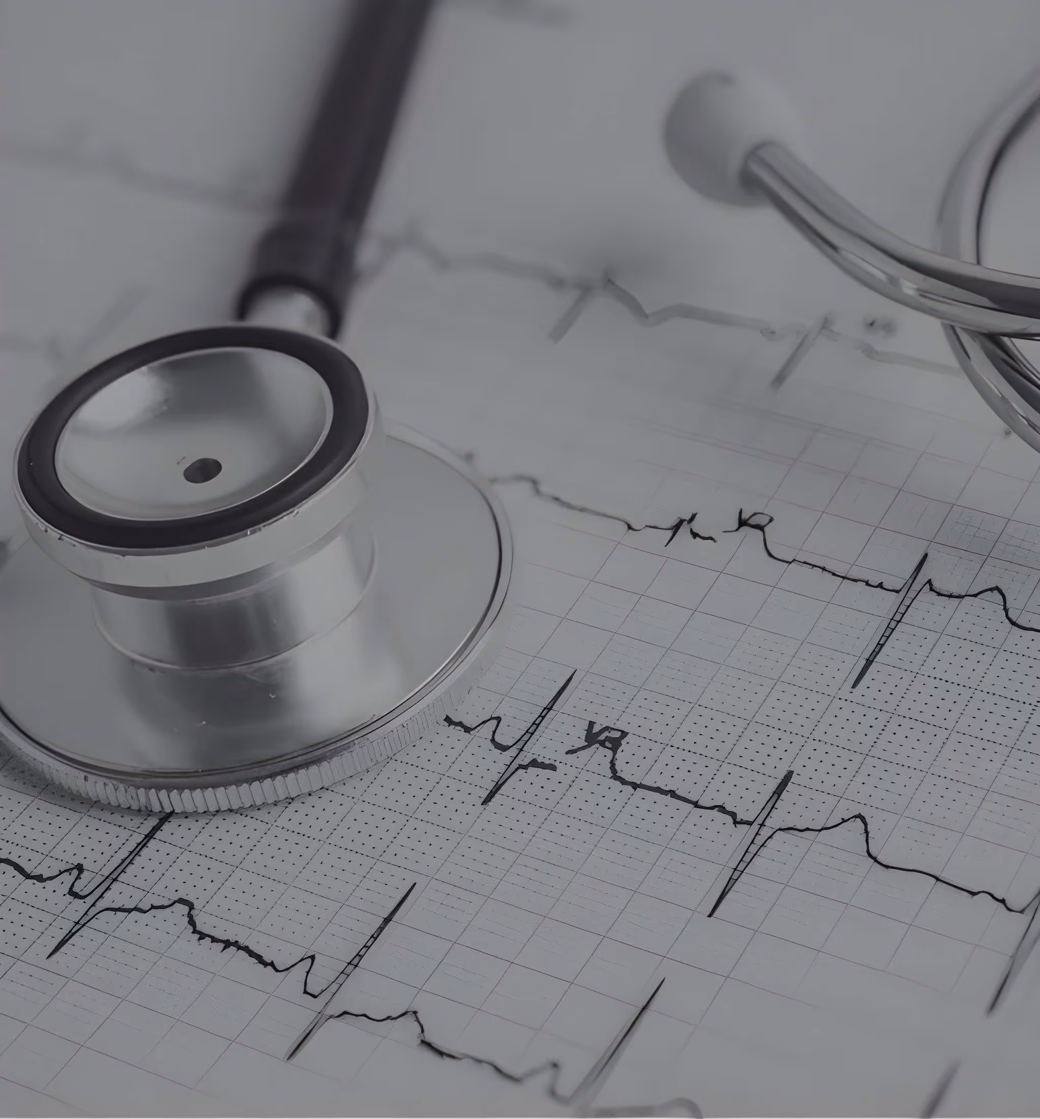 Stetoscopio appoggiato su un elettrocardiogramma con tracciati cardiaci visibili.