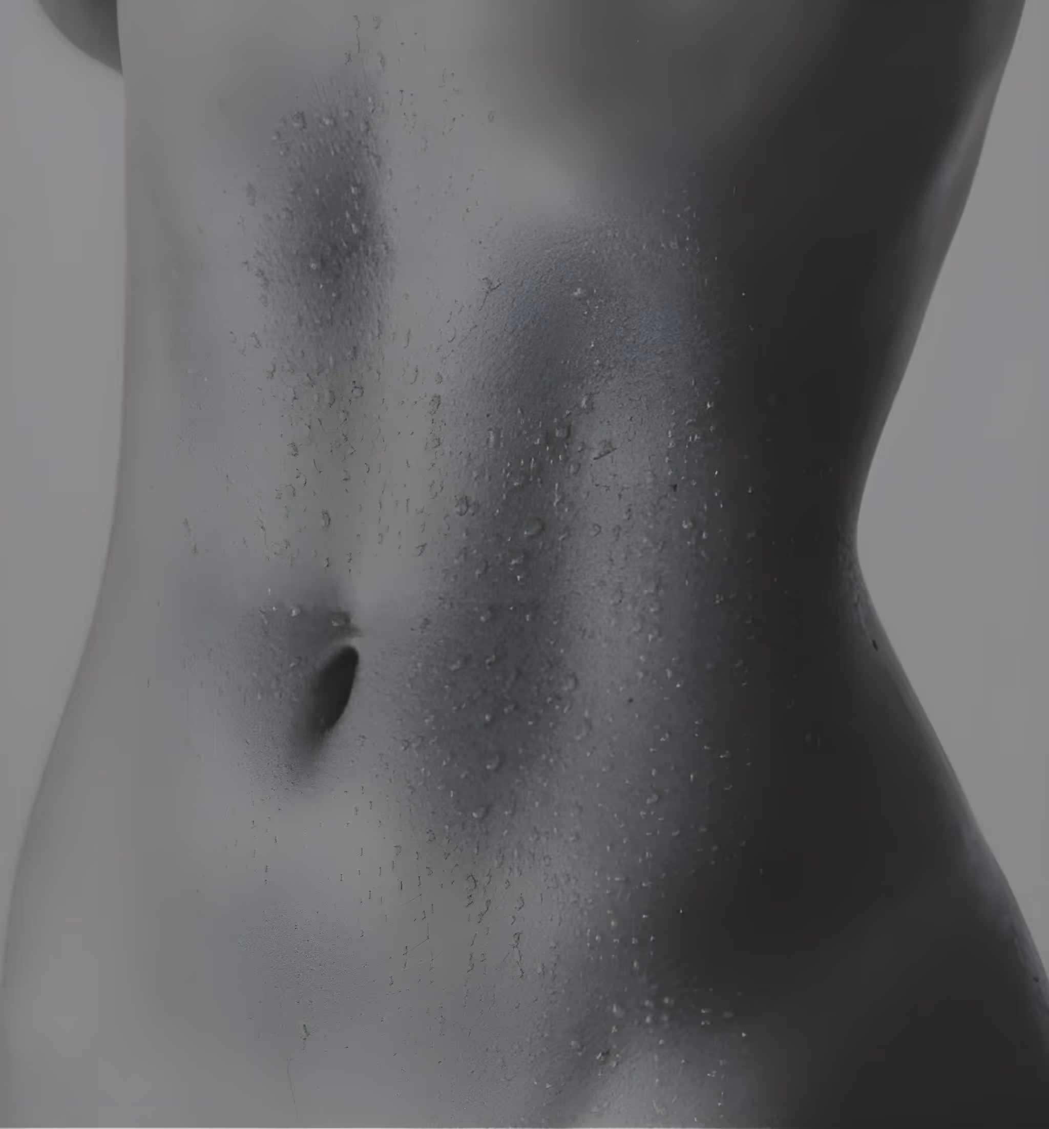 Criolipolisi Adiposita Localizzata Addome Fianchi Cosce Medicina
Estetica Brescia