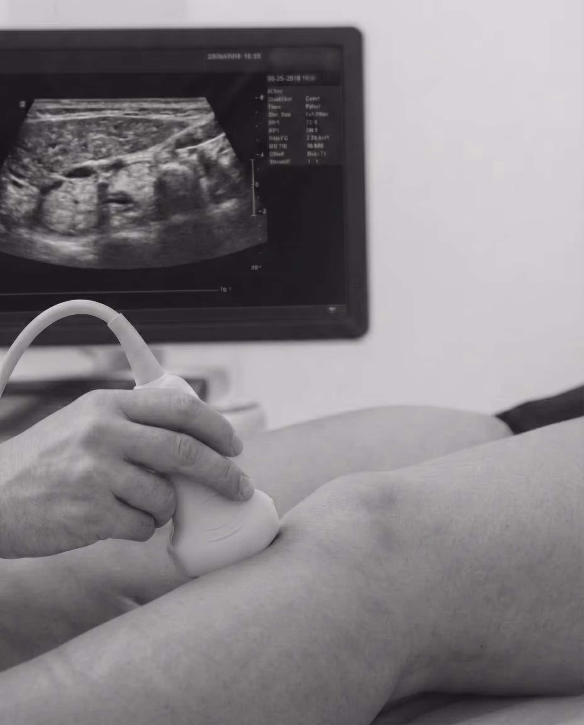 Ecografia della gamba in corso con monitor che mostra immagini dell'ecografia e mano di un medico che tiene la sonda sull'arto del paziente.