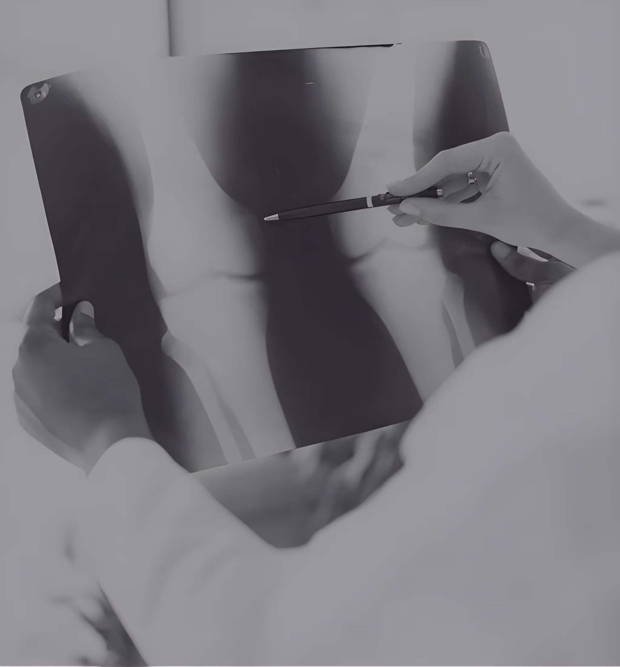 Medico che esamina una radiografia del ginocchio tenendo la lastra con una mano e indicando con una penna.