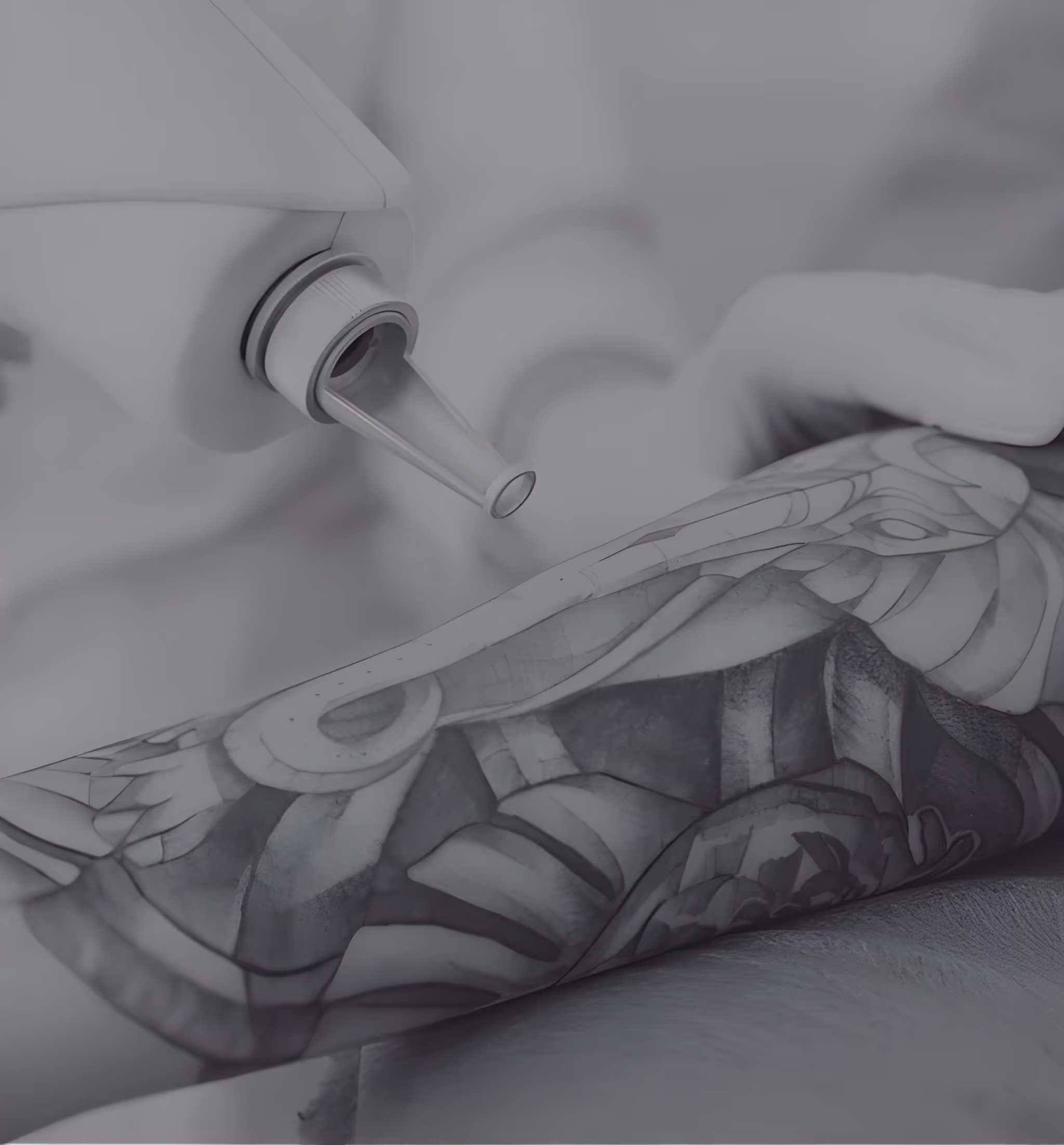 Laser Rimozione Macchie Cutanee Tatuaggi Centro Medicina
Estetica Tecnologico Brescia