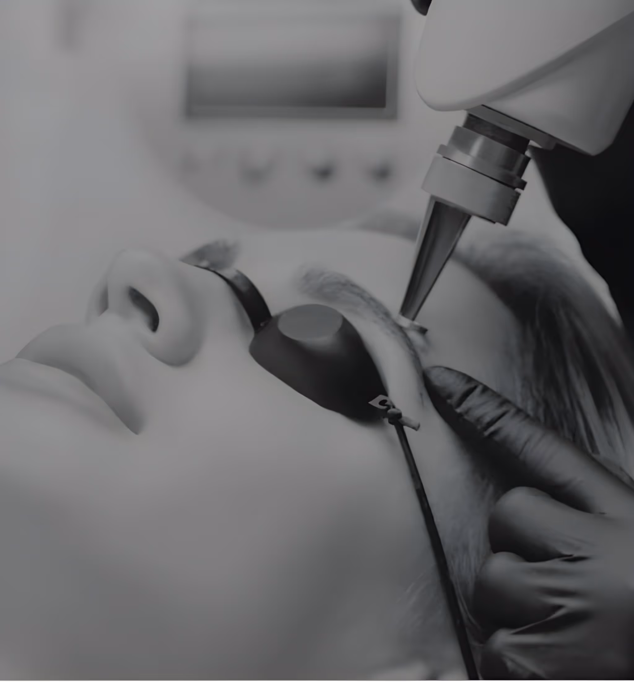 Rimozione Macchie Tatuaggi Laser Trattamento Estetico Pelle
Centro Laser Brescia