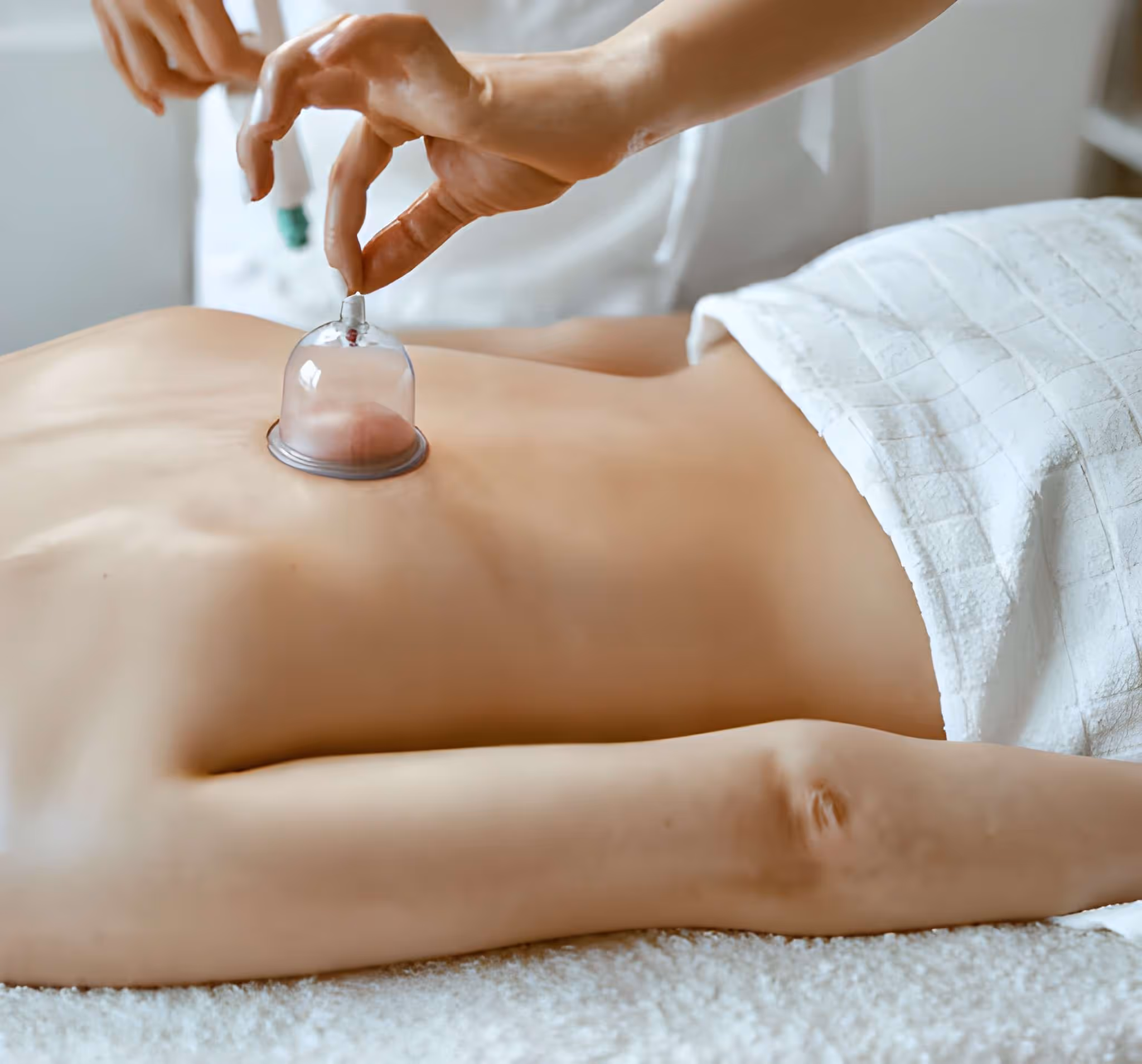 Terapia Con Coppettazione Per Dolori Muscolari E Recupero Funzionale A Brescia